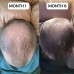 VITAFOAM ™ Hair Growth 3 Month's Supply Formula 