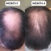 VITAFOAM ™ Hair Growth 3 Month's Supply Formula 