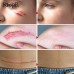 RtopR Scar Removal Cream, Rapid Repair of New Old Scars, Spots, Enhance Skin Elasticity, Clinically Shown to Make Scars Smaller and Less Visible