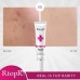 RtopR Scar Removal Cream, Rapid Repair of New Old Scars, Spots, Enhance Skin Elasticity, Clinically Shown to Make Scars Smaller and Less Visible