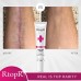 RtopR Scar Removal Cream, Rapid Repair of New Old Scars, Spots, Enhance Skin Elasticity, Clinically Shown to Make Scars Smaller and Less Visible