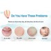 Buy Original BIOAQUA 4 Pcs Anti Acne Removal Face Care Acne Treatment Set