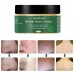 Acne Scar Remover Cream, Acne Treatment Cream, Acne Scar Cream, Acne Cream for Face, Balance Water And Oil, Perfect For Acne Scar Removal, Spots, 100g