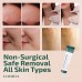 DABIDA Total Skin Tag Remover - Premium Mole and Skin Tag Removal Cream, No Chemical Removal, Improved Herbal Formula, Remove Moles, Skin Tags and Milia