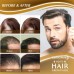 Hair Growth Serum - Biotin Hair Regrowth Oil Prevent Hair Loss and Natural Serum for Thicker, Stronger, Longer Hair Men and Women 1.18 Oz (35 mL)