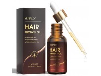 Hair Growth Oil with Biotin and Castor, Hair Growth Serum for Thicker Longer Healthier Hair, Promotes Hair Regrowth, Prevent Hair Loss and Thinning, Hair Regrowth Treatment Oil Gifts for Men and Women