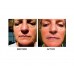 Buy 7E Myolift Professional Microcurrent Face Lift Machine Online in Pakistan