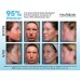 Buy Neutralyze Moderate To Severe Acne Clearing Serum & Synergyzer Online in Pakistan