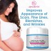 100% Retinol Free Stretch Mark Cream for Pregnancy & Scar Removal Online in Pakistan