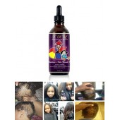 Buy Trl Children's Hair Growth Oil All-Natural Dry Scalp Hair Growth & Eczema Treatment For Sale In Pakistan