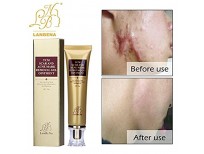 Buy Wisdompark Acne Scar Removal Cream Online in Pakistan
