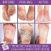 Buy NEW 2018 Exfoliating Foot Peel Mask For Soft Touch Online in Pakistan