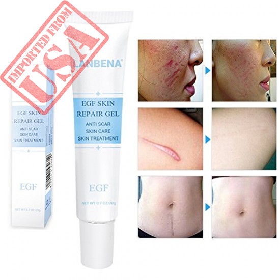 BUY EGF REPAIR GEL SCAR REMOVER CREAM - REPAIR FACE SCARS DEFENSE CREAM FOR PIMPLE, SURGICAL SCAR HYPERPLASIC SCAR, SCALDS, BURNS, ACNE MARKS AND POCKS (0.7OZ /20G) IMPORTED FROM USA