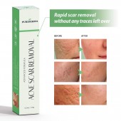 High Quality Acne Scar Removal Cream Treatment for Face imported from USA, for Sale in Pakistan