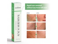 High Quality Acne Scar Removal Cream Treatment for Face imported from USA, for Sale in Pakistan