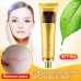 BUY ACNE SCAR REMOVAL CREAM SKIN REPAIR FACE CREAM BLACKHEAD WHITENING CREAM STRETCH MARKS FROM USA