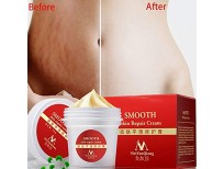 Buy EDTara Scar Removal Cream Online in Pakistan