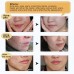2 Pcs TCM Scar Removal Cream, Skin Repair Face Cream Acne Spots Acne Treatment Stretch Marks 30ml (2 Pack)