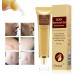 Scar Cream, Acne Scar Removal Cream,Acne Spots Treatment,Stretch Marks Relief and Burns Repair,Face Skin Repair Cream 30ml