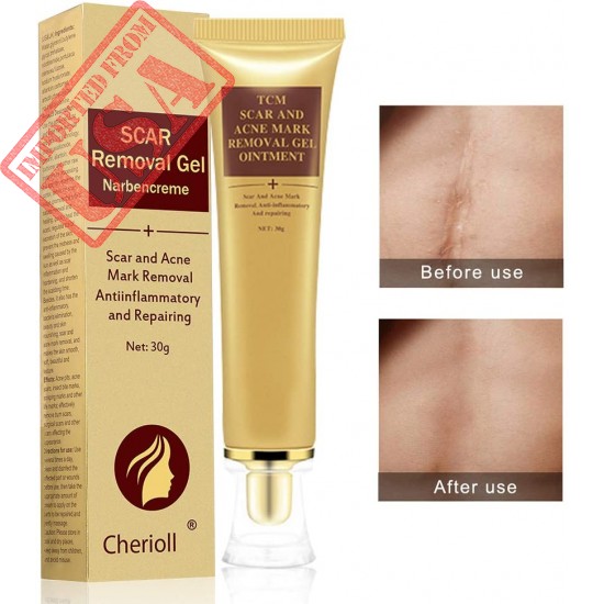 Best Acne Scar Removal Cream - Acne Spots Treatment & Stretch Marks Relief Buy in Pakistan