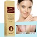 Scar Cream, Acne Scar Removal Cream,Acne Spots Treatment,Stretch Marks Relief and Burns Repair,Face Skin Repair Cream 30ml