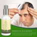 Buy Natural Hair Growth Oil with Caffeine and Biotin - Hair Growth Oil for Stronger, Thicker, Longer Hair in Pakistan