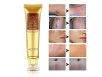 TCM Scar and Acne Mark Removal Gel, Stretch Marks, Skin Repair, Blackhead Whitening Cream in Pakistan