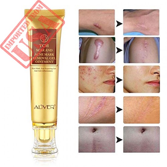 TCM Scar and Acne Mark Removal Gel, Stretch Marks, Skin Repair, Blackhead Whitening Cream in Pakistan