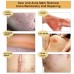 TCM Scar and Acne Mark Removal Gel, Stretch Marks, Skin Repair, Blackhead Whitening Cream in Pakistan