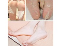 Get online Best Quality Foot Peel Mask in Pakistan 