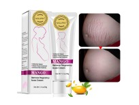 RtopR Mango Stretch Marks and Scar Cream -Stretch Marks and Scar Removal Cream for Pregnancy - Best Body Moisturizer-40g