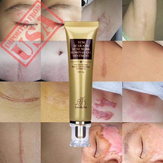 BUY 100% ORIGINAL LANBENA ACNE SCAR REMOVAL CREAM - SKIN REPAIR FACE CREAM IMPORTED FROM USA