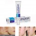 BUY HIGH QUALITY WFFO EFFECTIVE FACE SKIN CARE REMOVAL CREAM, ACNE SPOTS SCAR BLEMISH MARKS TREATMENT (WHITE) IMPORTED FROM USA