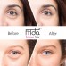 PUFFY EYE CREAM - Instant results – Reduces Puffiness and Eye Bags Online in Pakistan
