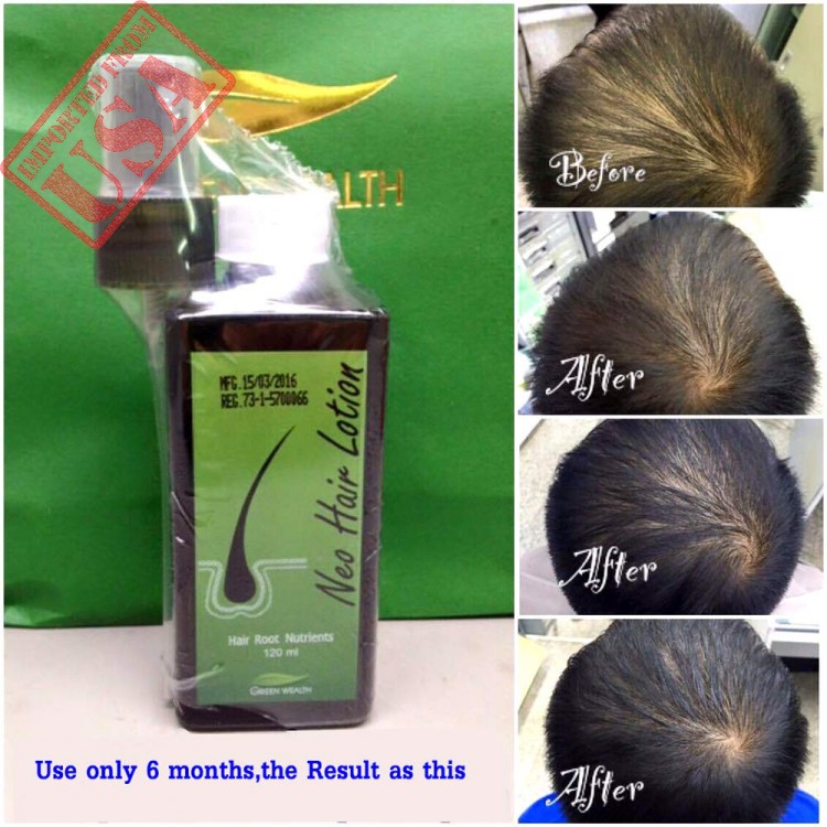 Neo Hair Lotion for sale & price in Ethiopia | Engocha.com
