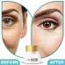Best Anti Aging Wrinkle Remover Eye Gel | Reduces Appearance of Dark Circles Online in Pakistan