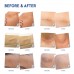 Buy Reusable Silicone Scar Removal Sheets by Tatyana Naturals Cure for Stretch Marks, Surgery Scars, C-Section, Acne Scars