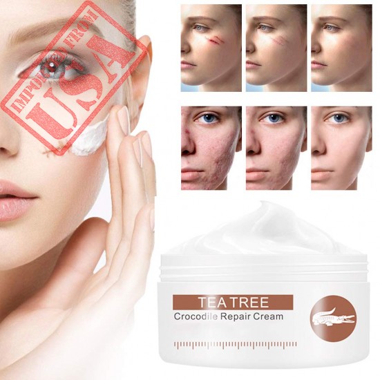 Imported Scar Removal Cream | Lightens Old & New Scars Shop in Pakistan