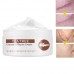 Imported Scar Removal Cream | Lightens Old & New Scars Shop in Pakistan