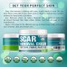 Shop Effective Stretch Mark Removal Cream - Advanced Treatment for Old Scars & Acne Scars - Made in USA