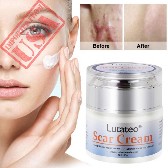 Buy Face Skin Repair Cream | Acne Scars & Stretch Marks Removal Cream in Pakistan