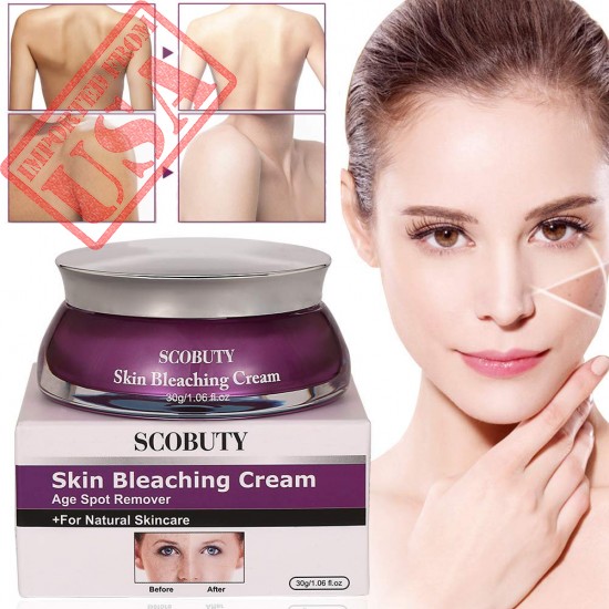 Scobuty Skin Bleaching Cream For Melasma, Freckle, Dark Spot & Pigmentation In Pakistan