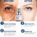 Buy Imported Anti Wrinkle Eye Serum | Dark Circles Treatment | Serum for Fine Lines, Under Eye Bags