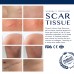 Buy Advance Silicone Scar Gel Scar Remover Gel for Scars from C-Section, Stretch Marks, Acne, Surgery in Pakistan