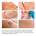 Buy Advance Silicone Scar Gel Scar Remover Gel for Scars from C-Section, Stretch Marks, Acne, Surgery in Pakistan