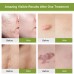 Natural Scar Removal Gel | Acne Scar Treatment Sale in Pakistan