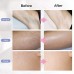 IPL Hair Removal System for Women and Men IPL Hair Removal Device 600,000 Flashes Facial Body Profesional Use at Home