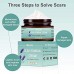 Buy Top Selling Scar Removal Cream | Effective for Ance Scars, Surgery Scars & Stretch Marks