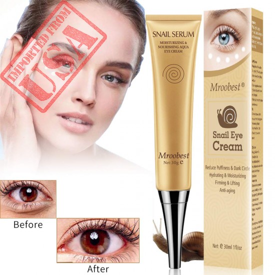 Perfect Anti Aging Eye Cream for Dark Circles, Puffiness & Under Eye Bags Buy in Pakistan