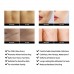 AZALLY Advanced Scar Gel - Scar Diminishing Serum - Reduces the Appearance of Old & New Scars - Best Scar Treatment for Repair Scars from Burns Cuts Acne Spots Stretch Marks - 1oz. 